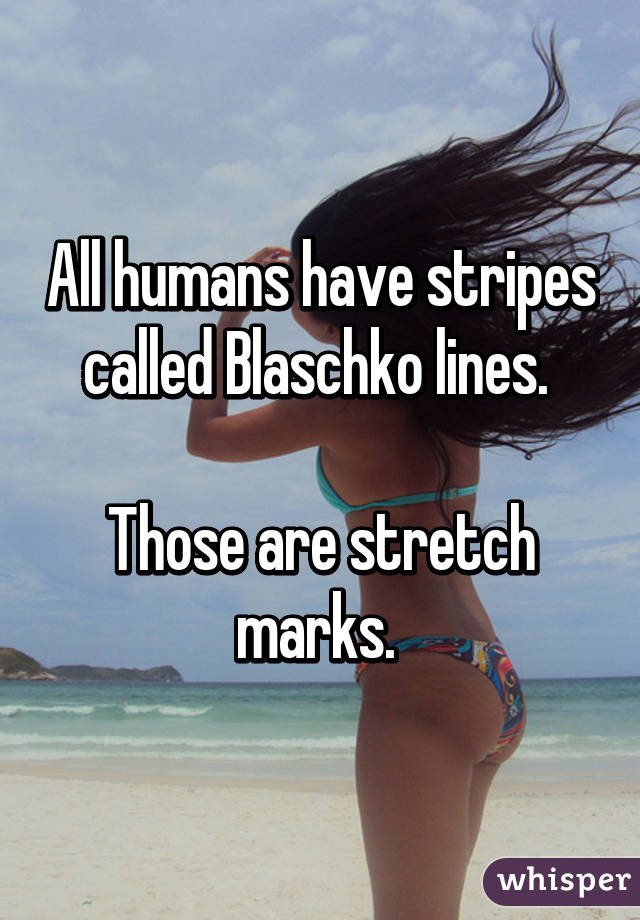 All humans have stripes called Blaschko lines. 

Those are stretch marks. 