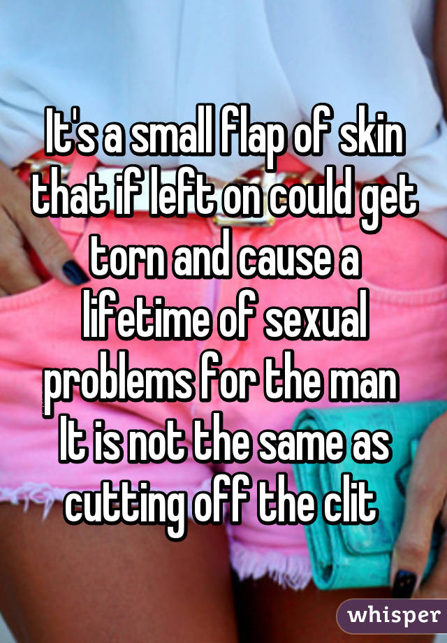 It's a small flap of skin that if left on could get torn and cause a lifetime of sexual problems for the man 
It is not the same as cutting off the clit 