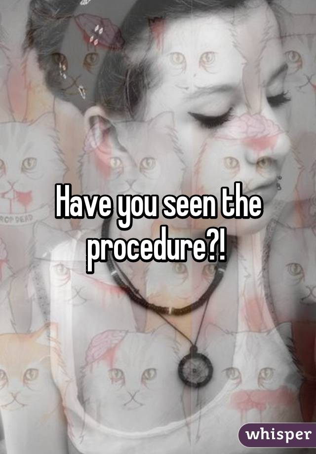 Have you seen the procedure?! 