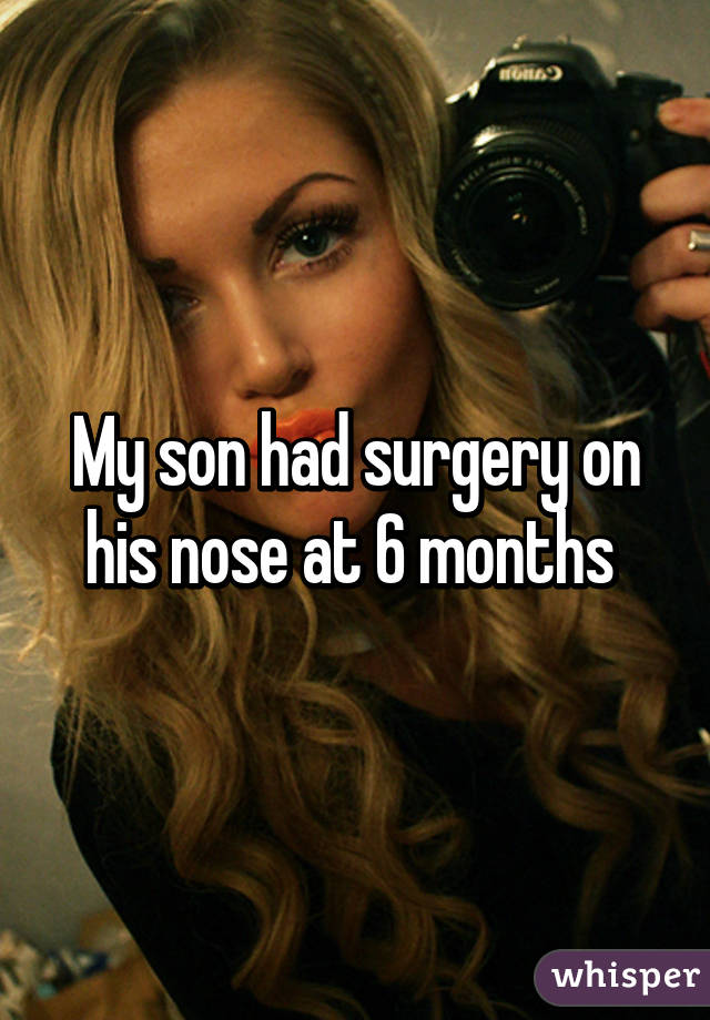 My son had surgery on his nose at 6 months 