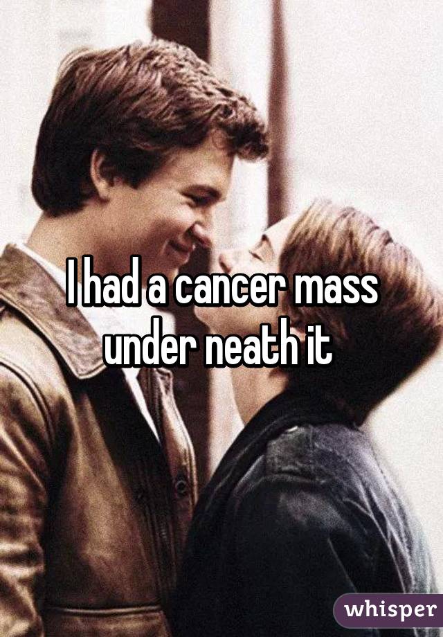 I had a cancer mass under neath it 