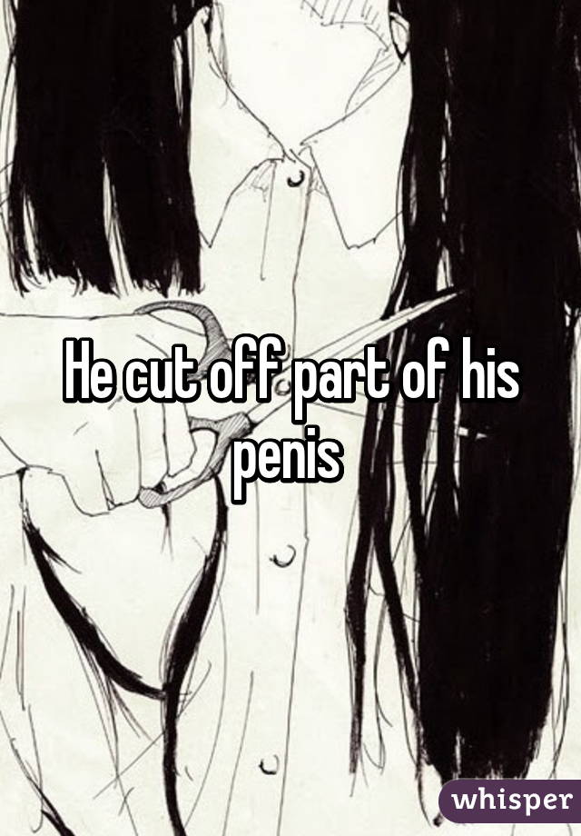 He cut off part of his penis 