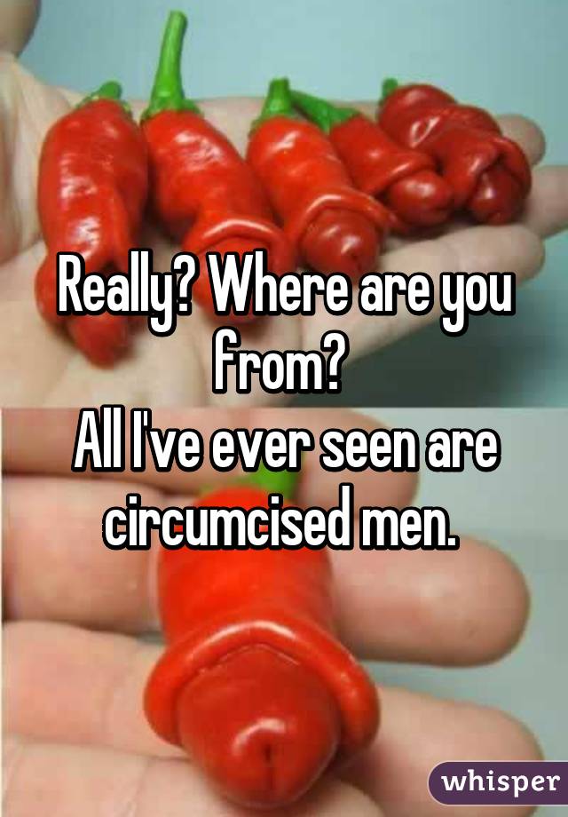 Really? Where are you from? 
All I've ever seen are circumcised men. 