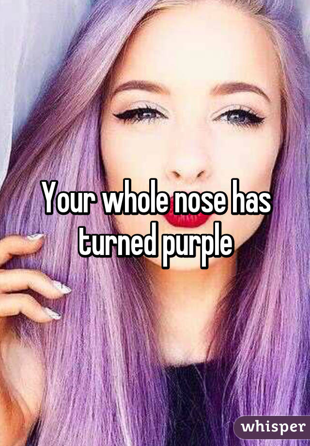 Your whole nose has turned purple