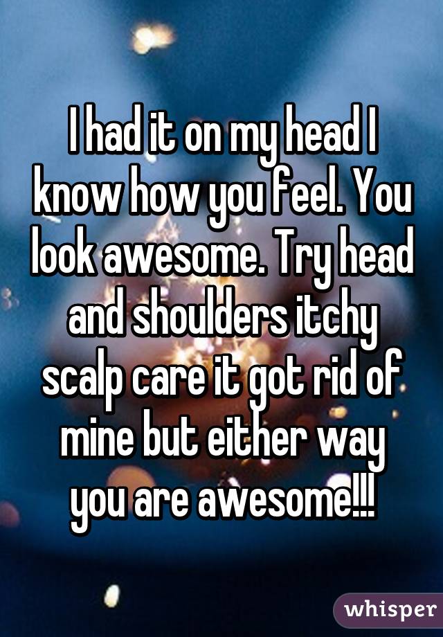 I had it on my head I know how you feel. You look awesome. Try head and shoulders itchy scalp care it got rid of mine but either way you are awesome!!!