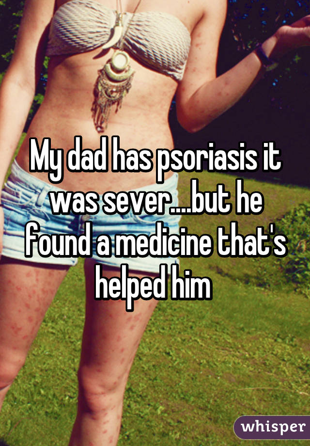My dad has psoriasis it was sever....but he found a medicine that's helped him 