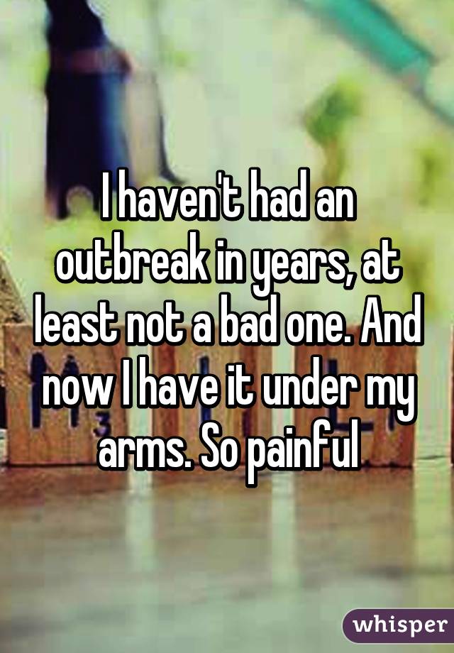 I haven't had an outbreak in years, at least not a bad one. And now I have it under my arms. So painful