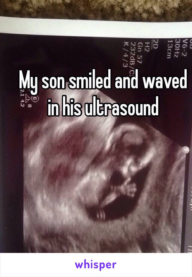 My son smiled and waved in his ultrasound 