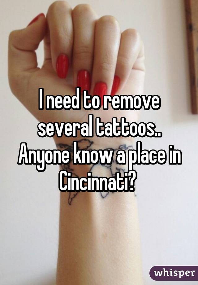 I need to remove several tattoos.. Anyone know a place in Cincinnati? 