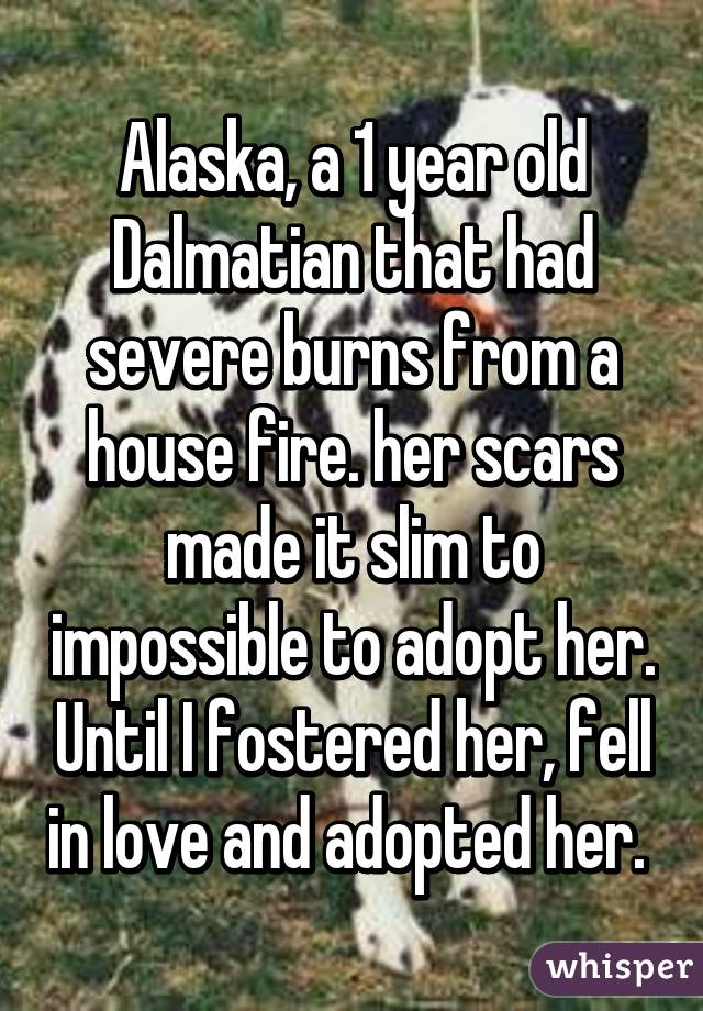 Alaska, a 1 year old Dalmatian that had severe burns from a house fire. her scars made it slim to impossible to adopt her. Until I fostered her, fell in love and adopted her. 