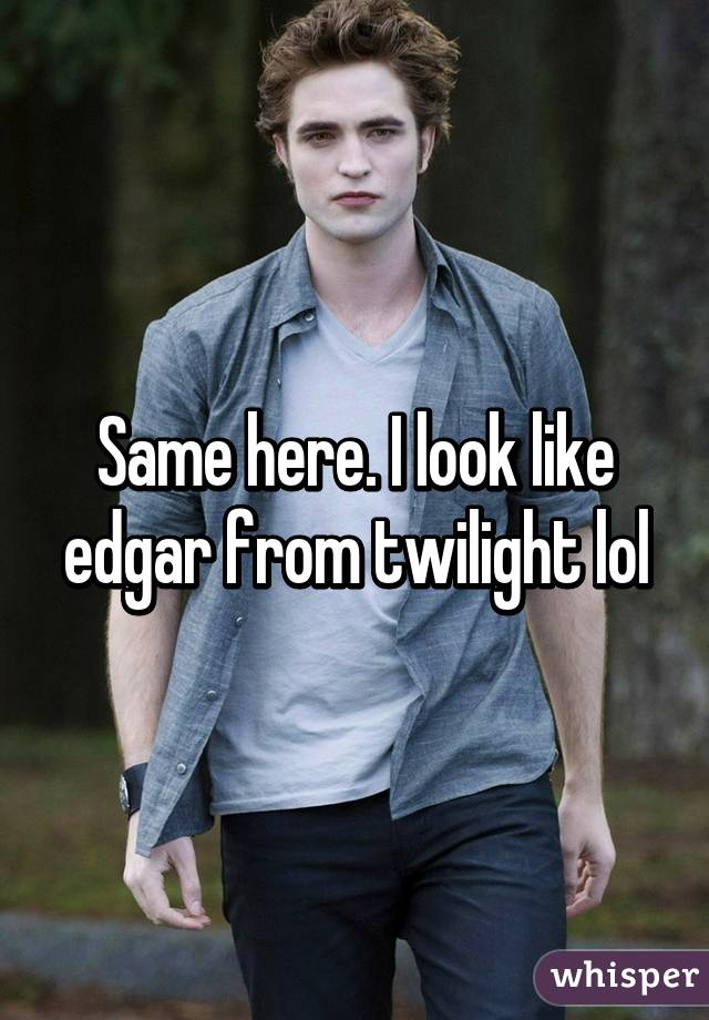 Same here. I look like edgar from twilight lol