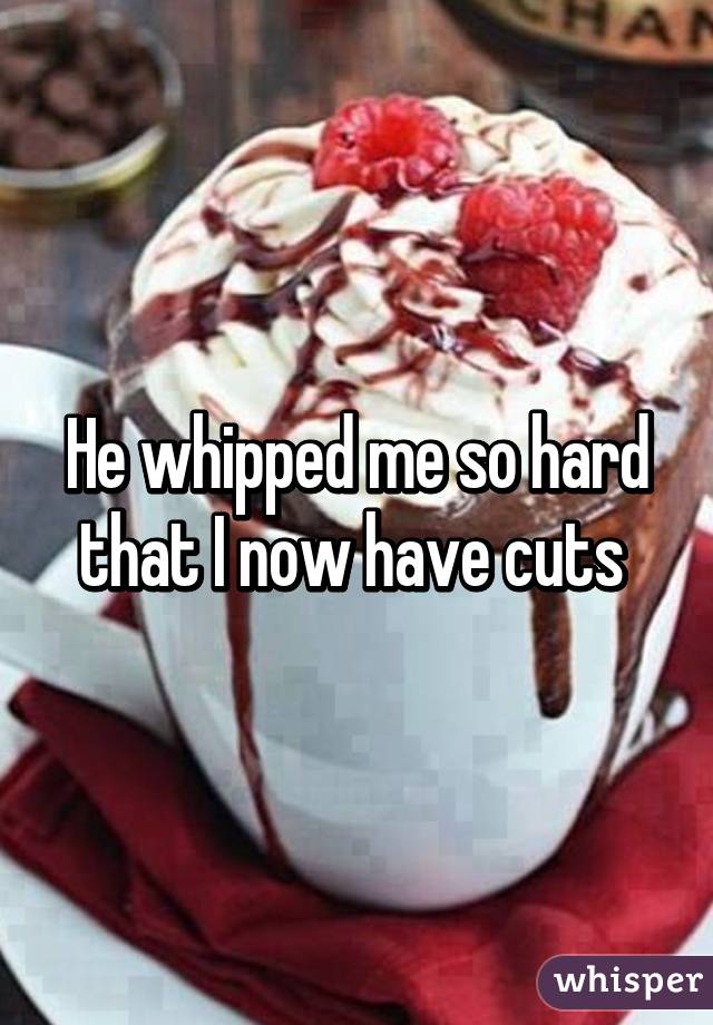 He whipped me so hard that I now have cuts 