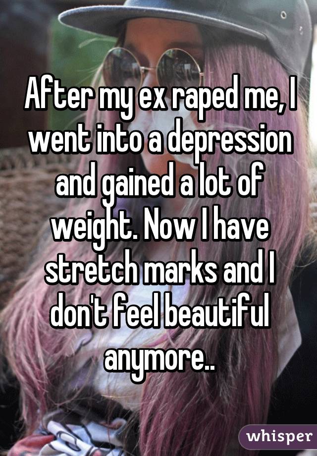 After my ex raped me, I went into a depression and gained a lot of weight. Now I have stretch marks and I don't feel beautiful anymore..