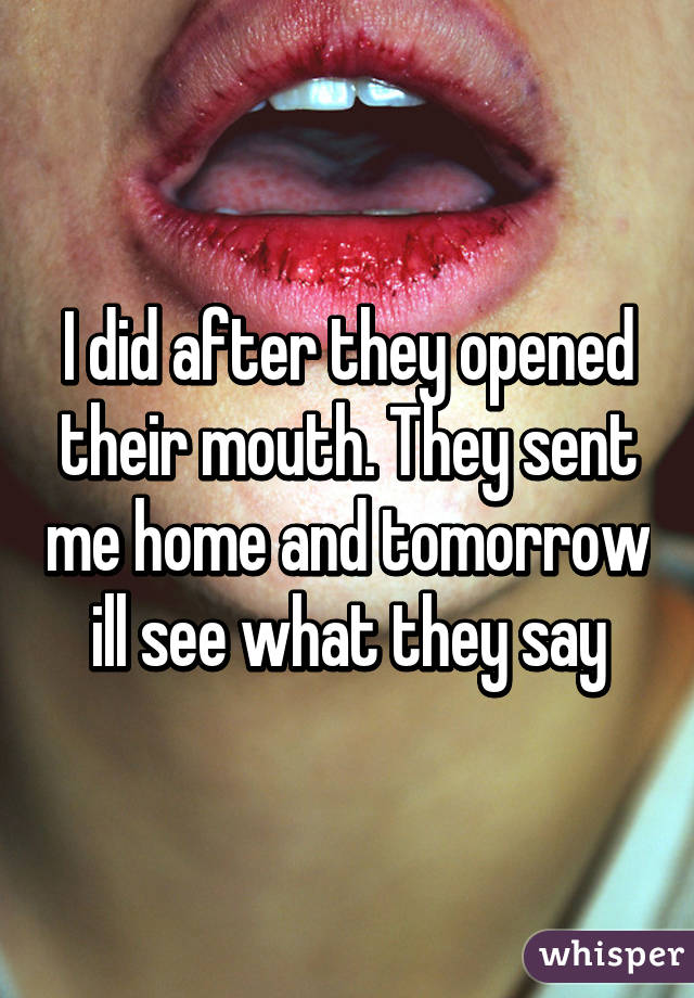 I did after they opened their mouth. They sent me home and tomorrow ill see what they say