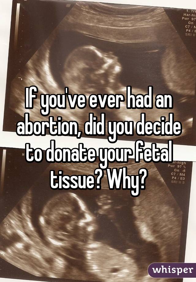 If you've ever had an abortion, did you decide to donate your fetal tissue? Why?