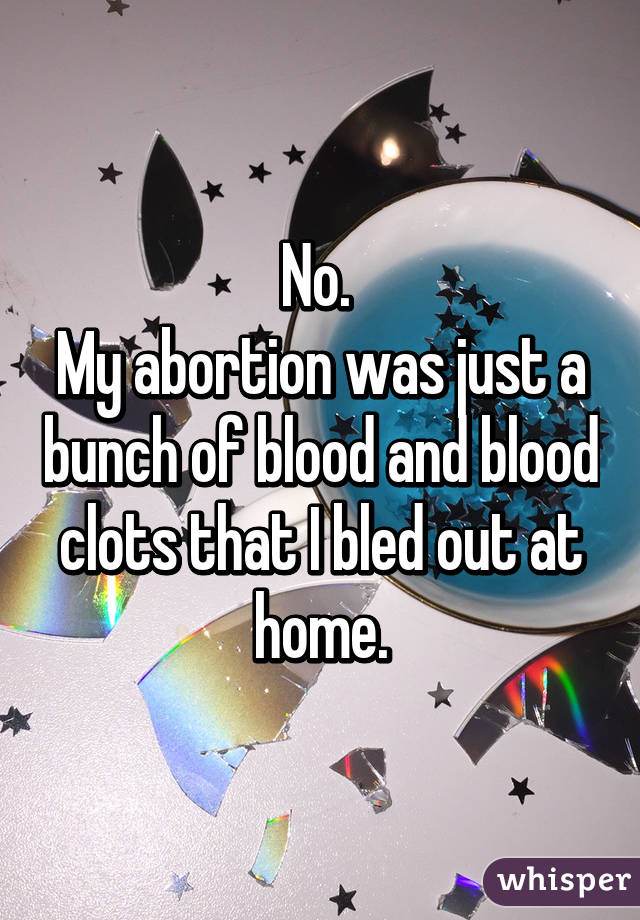 No. 
My abortion was just a bunch of blood and blood clots that I bled out at home.