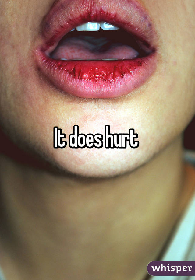 It does hurt 