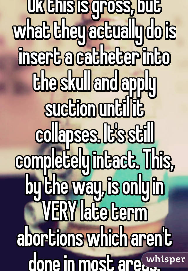 Ok this is gross, but what they actually do is insert a catheter into the skull and apply suction until it collapses. It's still completely intact. This, by the way, is only in VERY late term abortions which aren't done in most areas.