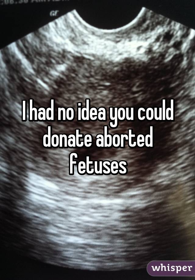 I had no idea you could donate aborted fetuses