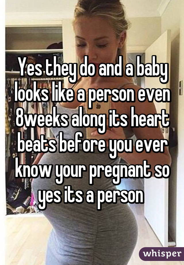 Yes they do and a baby looks like a person even 8weeks along its heart beats before you ever know your pregnant so yes its a person 