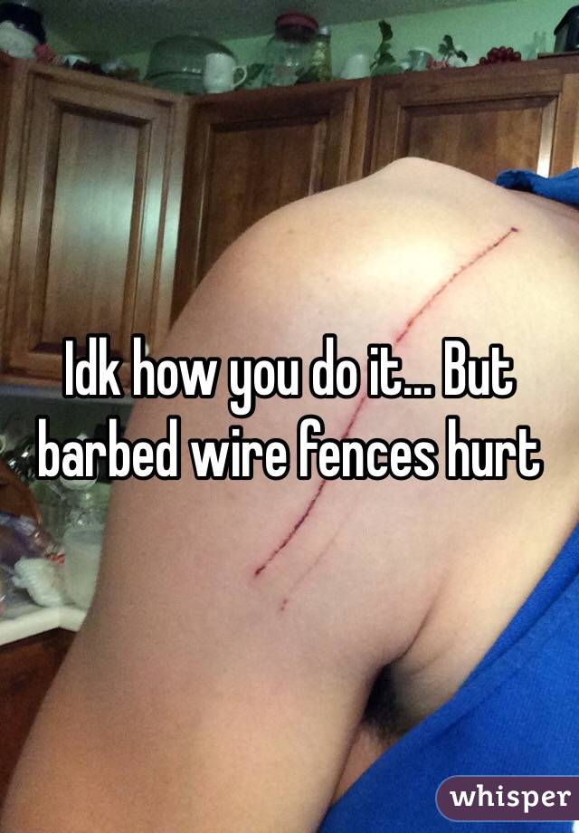 Idk how you do it... But barbed wire fences hurt