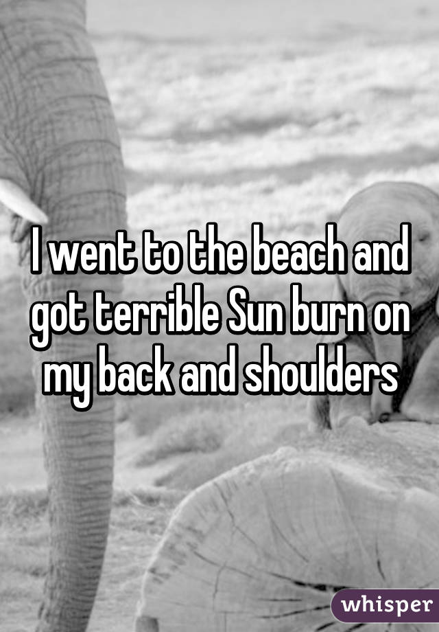 I went to the beach and got terrible Sun burn on my back and shoulders