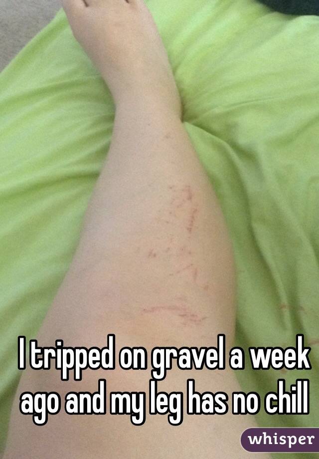 I tripped on gravel a week ago and my leg has no chill