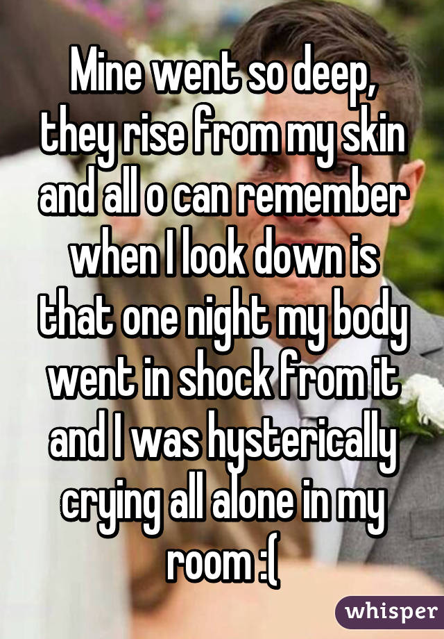 Mine went so deep, they rise from my skin and all o can remember when I look down is that one night my body went in shock from it and I was hysterically crying all alone in my room :(