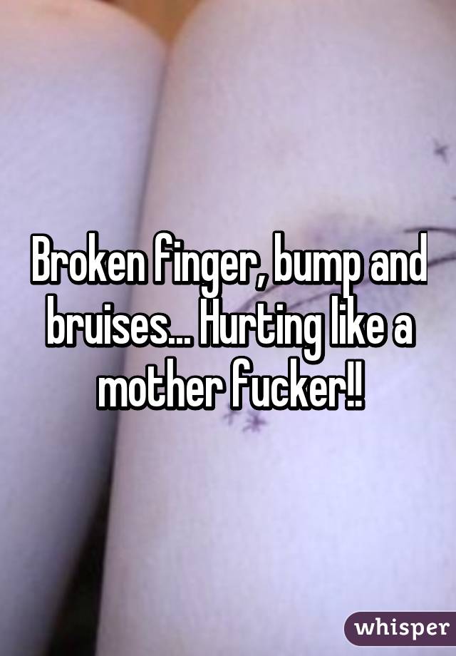 Broken finger, bump and bruises... Hurting like a mother fucker!!