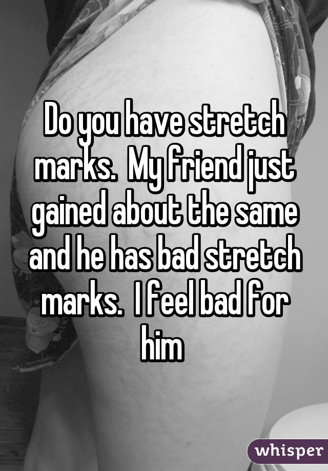 Do you have stretch marks.  My friend just gained about the same and he has bad stretch marks.  I feel bad for him 