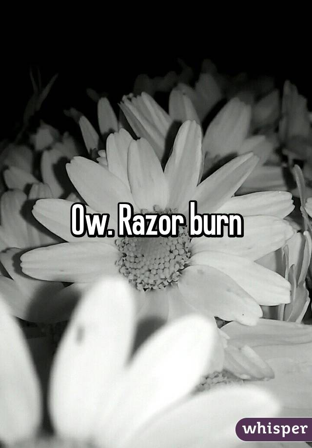 Ow. Razor burn