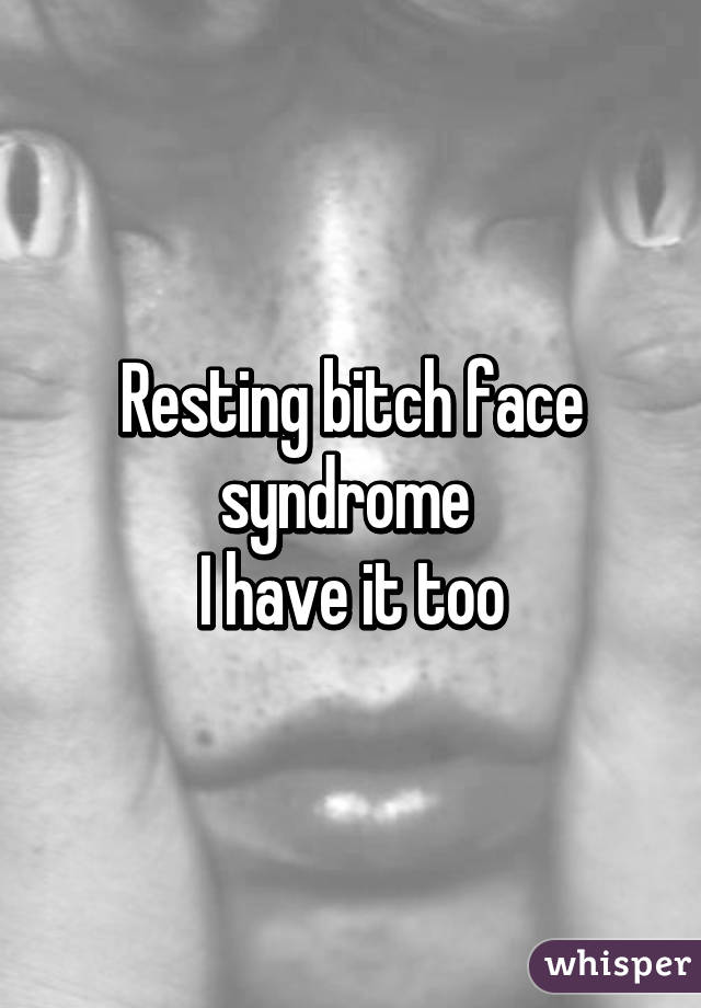 Resting bitch face syndrome 
I have it too