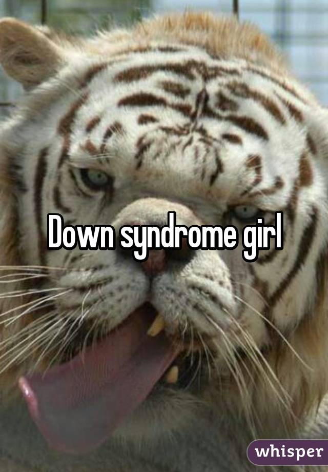 Down syndrome girl