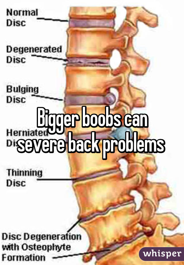 Bigger boobs can severe back problems 
