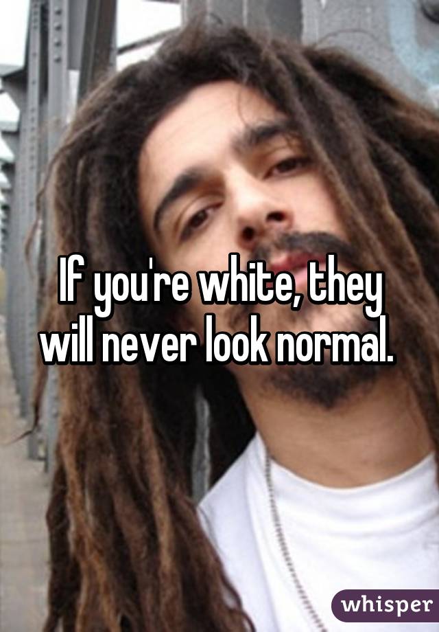 If you're white, they will never look normal. 