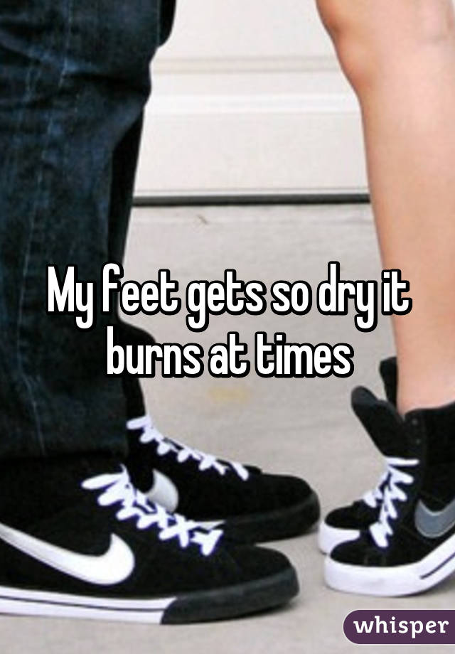 My feet gets so dry it burns at times