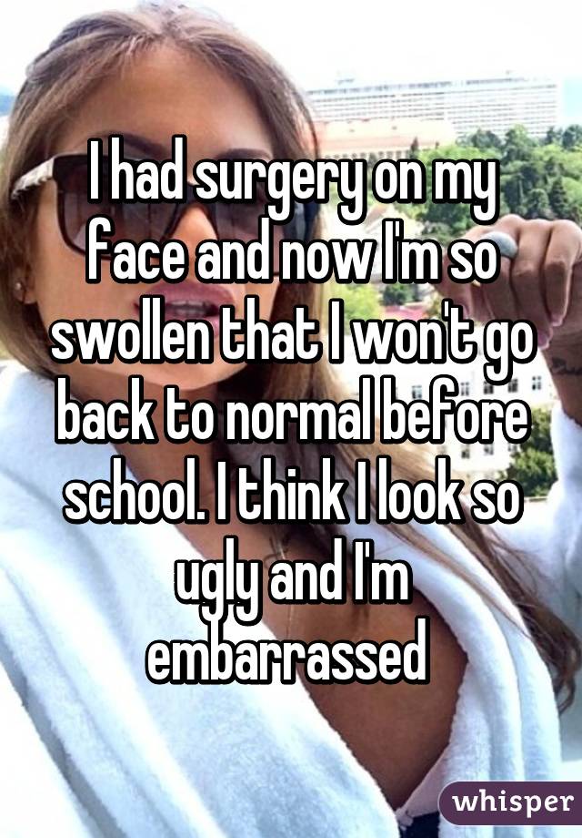 I had surgery on my face and now I'm so swollen that I won't go back to normal before school. I think I look so ugly and I'm embarrassed 