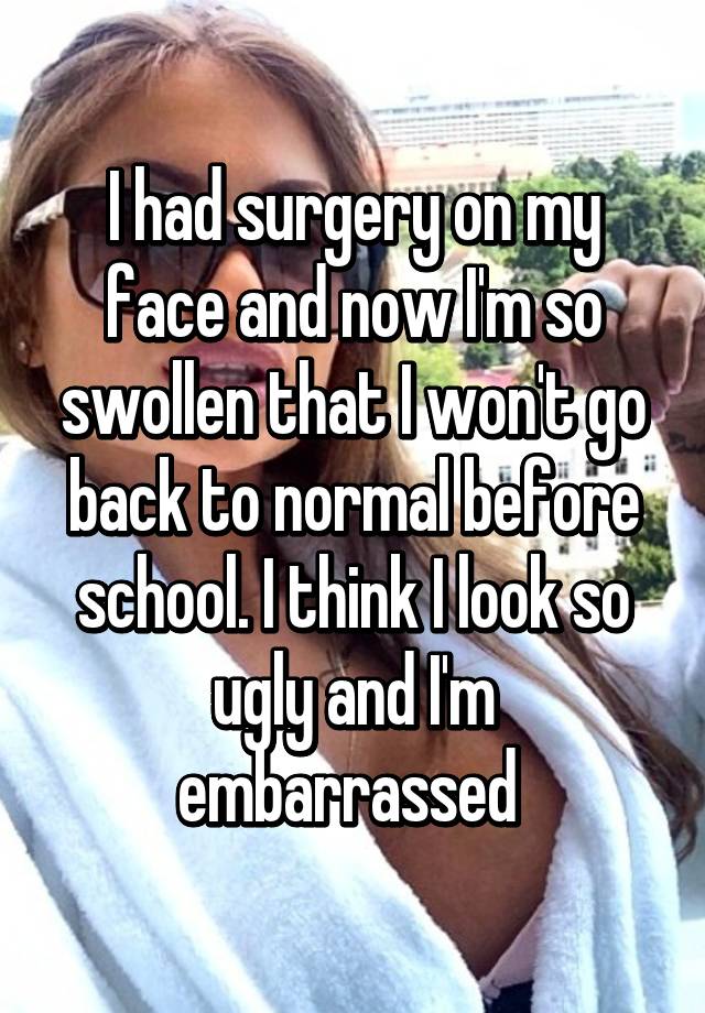 I had surgery on my face and now I'm so swollen that I won't go back to normal before school. I think I look so ugly and I'm embarrassed 