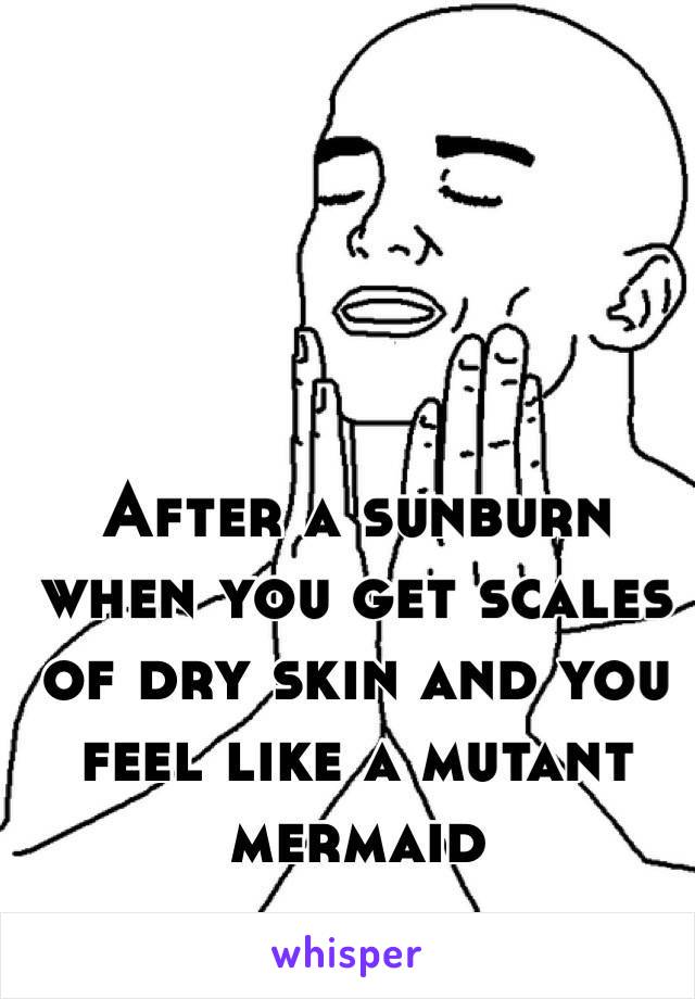 After a sunburn when you get scales of dry skin and you feel like a mutant mermaid