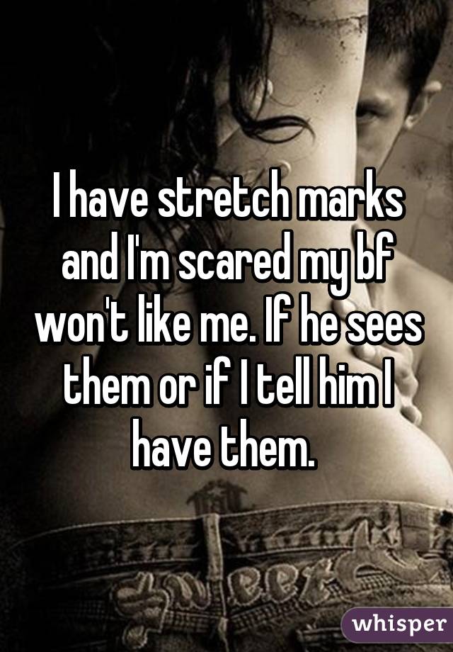 I have stretch marks and I'm scared my bf won't like me. If he sees them or if I tell him I have them. 