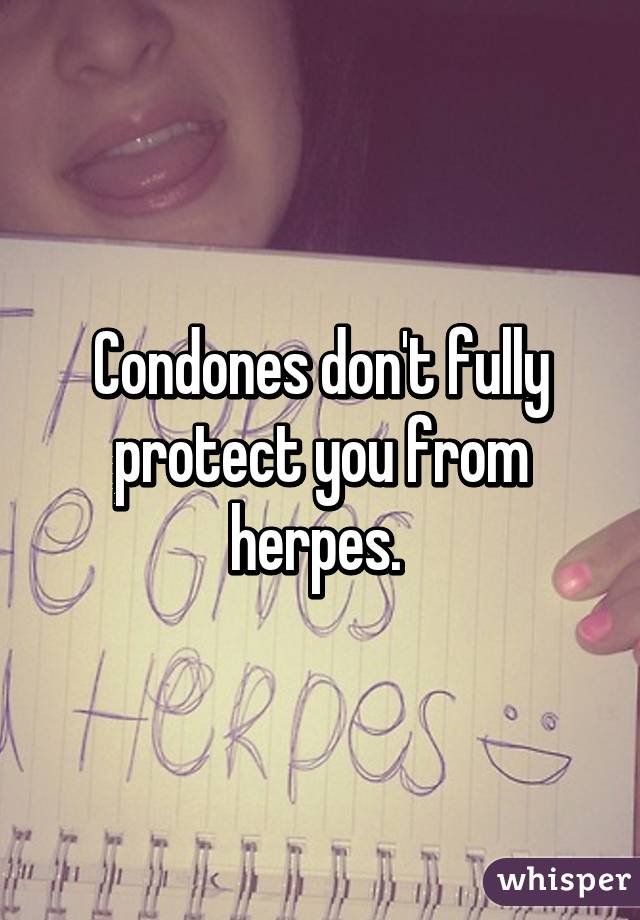 Condones don't fully protect you from herpes. 