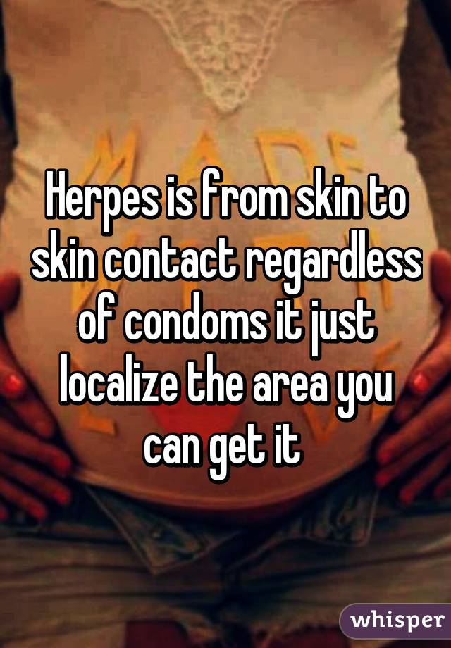 Herpes is from skin to skin contact regardless of condoms it just localize the area you can get it 