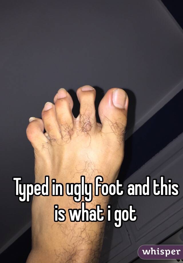 Typed in ugly foot and this is what i got 