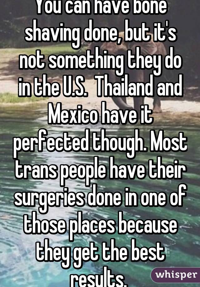 You can have bone shaving done, but it's not something they do in the U.S.  Thailand and Mexico have it perfected though. Most trans people have their surgeries done in one of those places because they get the best results. 
