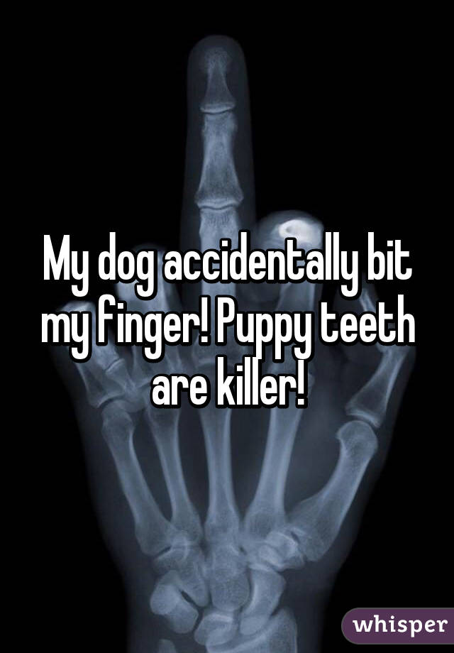 My dog accidentally bit my finger! Puppy teeth are killer!