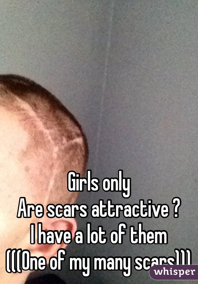 Girls only
Are scars attractive ?
I have a lot of them
(((One of my many scars)))