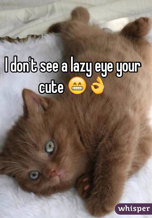 I don't see a lazy eye your cute 😁👌