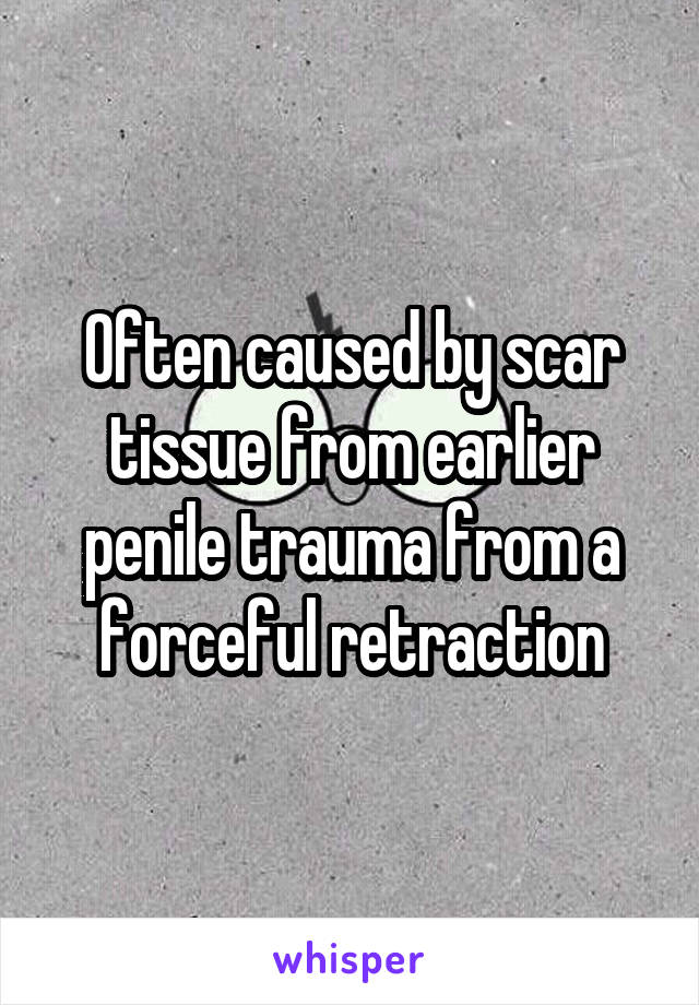 Often caused by scar tissue from earlier penile trauma from a forceful retraction