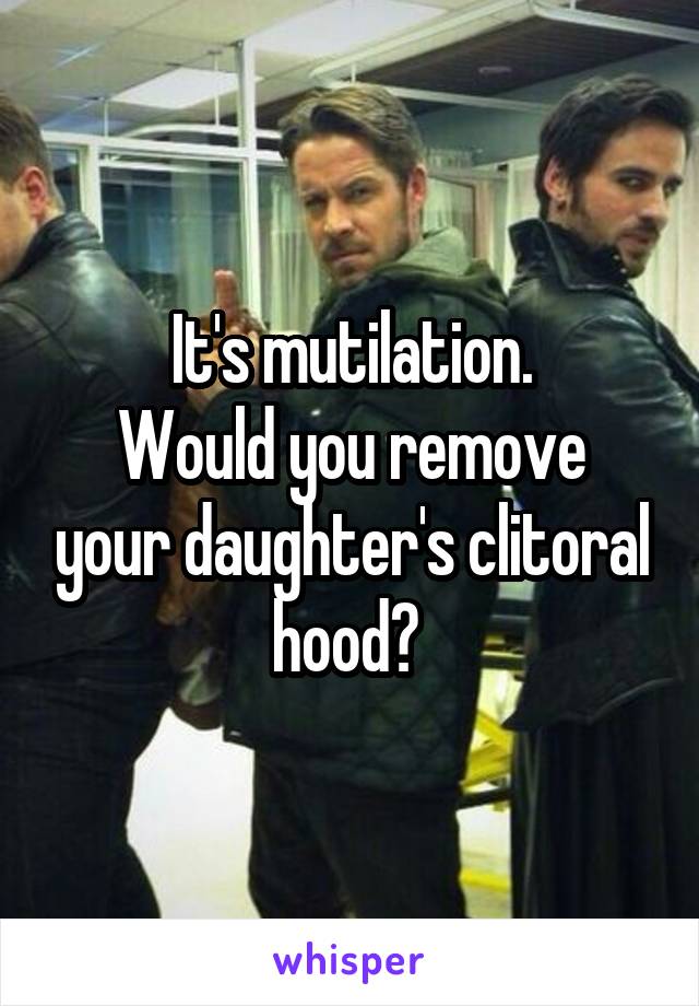 It's mutilation.
Would you remove your daughter's clitoral hood? 