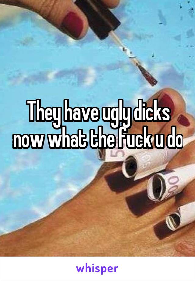 They have ugly dicks now what the fuck u do 